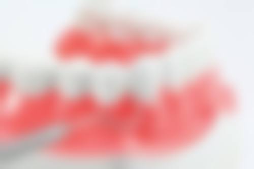 珠海牙科做全口牙橋幾多錢 單顆vs全口價錢對比(附香港差價)