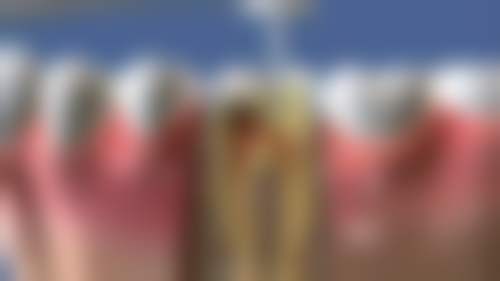 八、深圳市口腔医院收费价格表