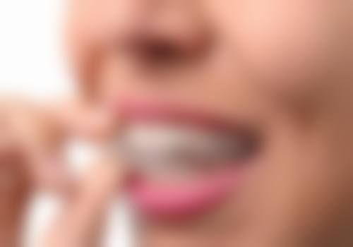 儿童补牙半年就掉了怎么办？2026避坑指南：5岁孩子补牙半年后牙疼，根源与3K方案全解析