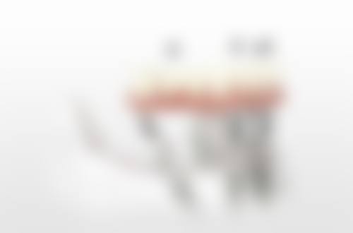 理性提醒