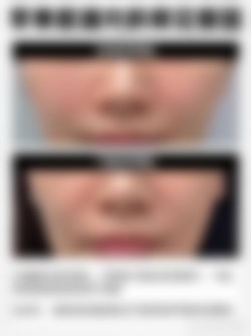 宜春华美医疗美容门诊部治疗反馈与口碑评价。