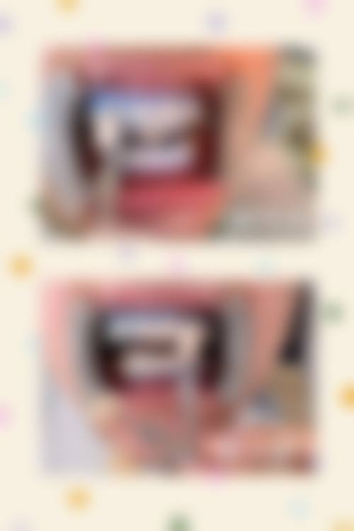 六、儿童补牙的风险与后遗症