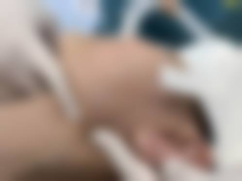 别府Luce诊所擅长项目。