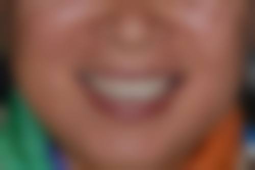 四川攀枝花雅致口腔医生团队经验稳定。