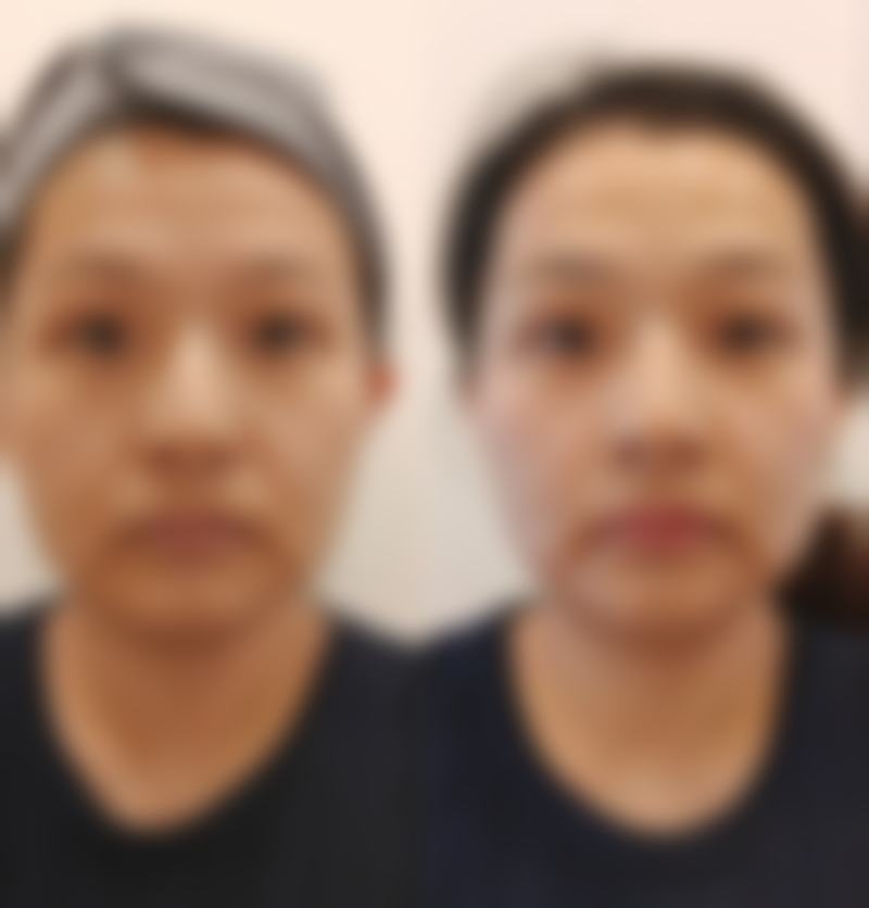 重庆威妮整形医院治疗反馈与口碑评价。