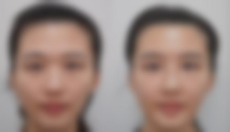 尹向欣医生擅长项目