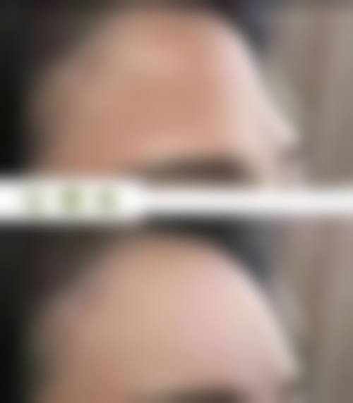武汉碧莲盛植发地理位置便于到院。