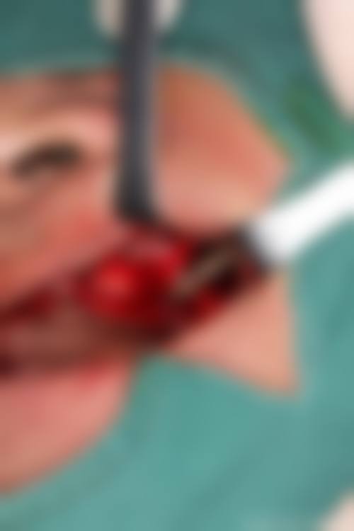 江苏苏州太仓羽承口腔地理位置便于到院。