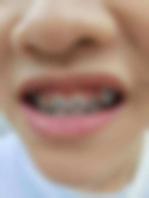 曲靖口腔医院的设备优势