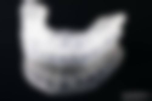 广东梅州立杨口腔医院钻石门诊疗疗反馈与口碑评价。