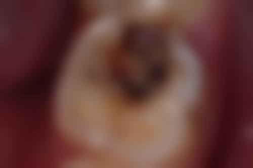 苏州姑苏区鲍嘉博口腔诊所擅长项目。