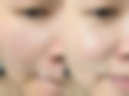 济南梅奥医疗美容门诊部预约挂号方式。