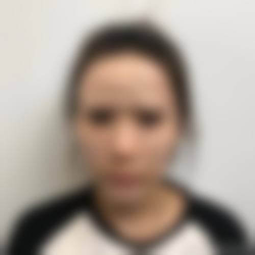 武汉碧莲盛植发医生团队经验稳定。