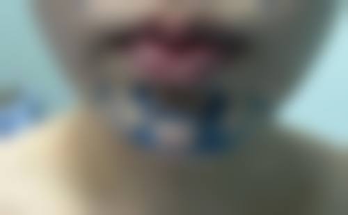 临沂盖娅医疗美容门诊部门诊营业时间。