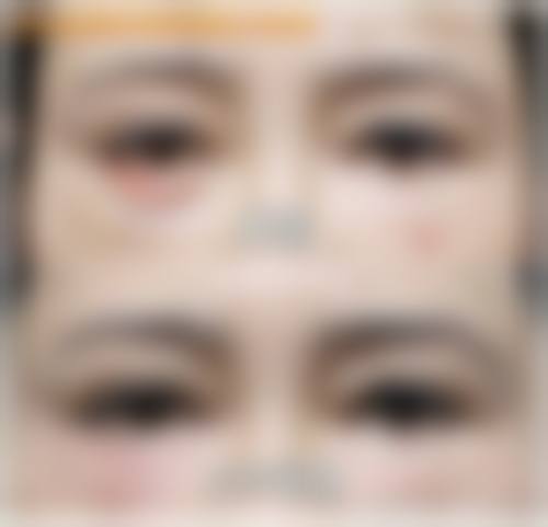济南梅奥医疗美容门诊部治疗反馈与口碑评价。