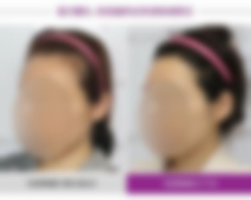 临沂盖娅医疗美容门诊部预约挂号方式。