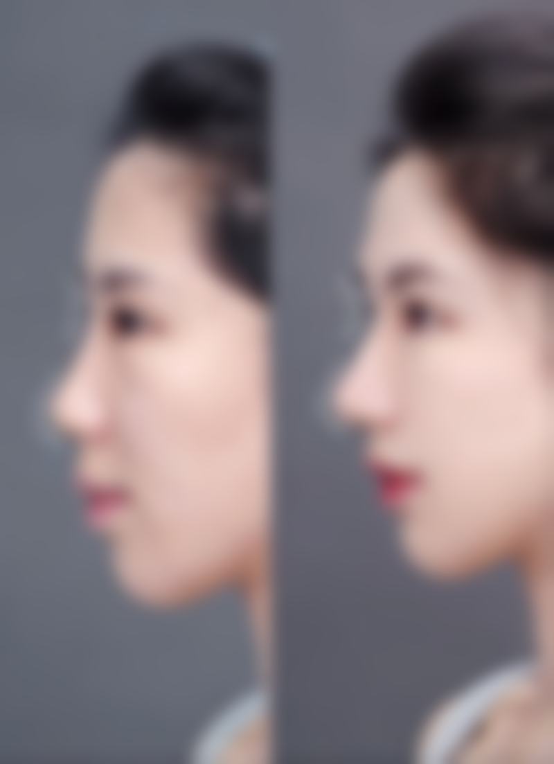 内江达芬奇（原内江瑞美）医疗美容整形门诊部医生团队经验稳定。