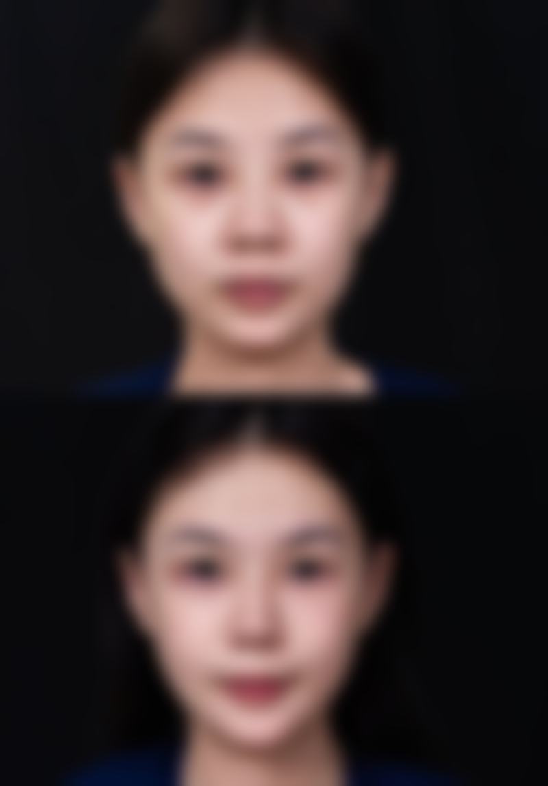 厦门长庚医院整形美容科口碑评价