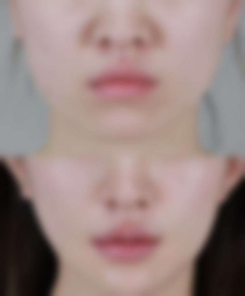 沈阳石枫医疗整形美容诊所预约挂号方式。