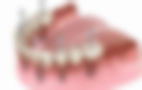 湖南娄底雅康囗腔2026年价格收费表：