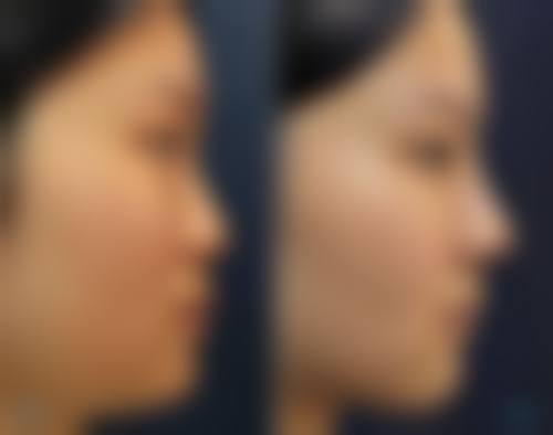 兰州军区陆 军总院整形美容中 心治疗反馈与口碑评价。