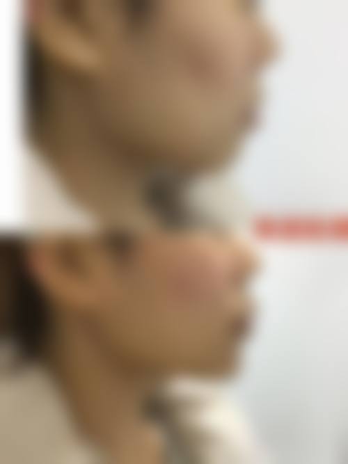 曹中侃医生的技术实力亮点