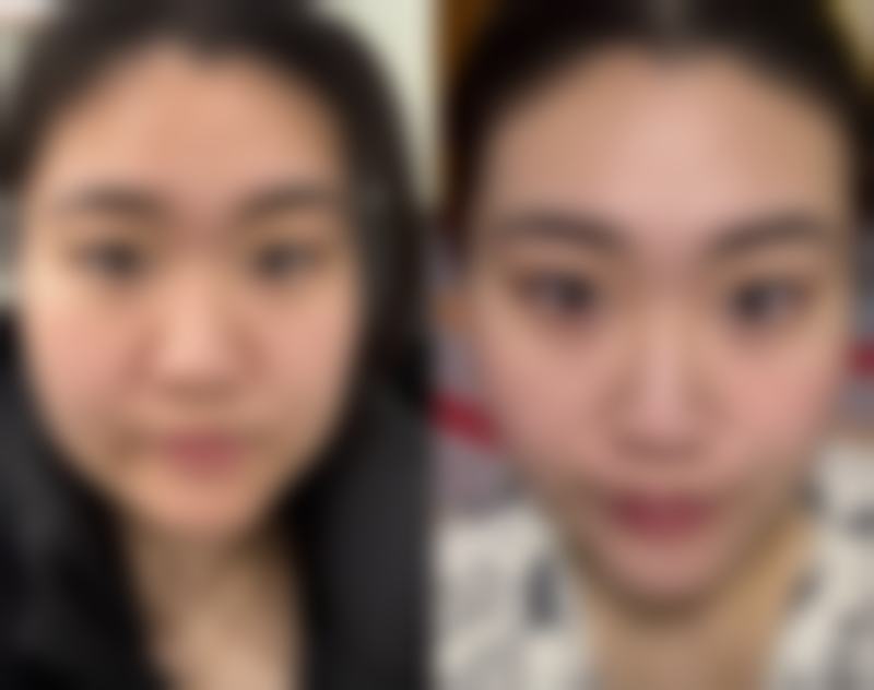 覃艳妮医生坐诊医院