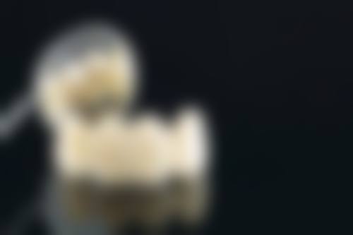 拓展延伸:港澳朋友種牙常見問題Q&A