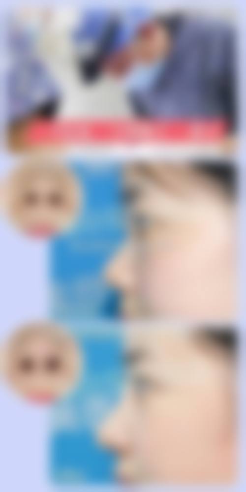 宁海雅太医疗美容诊所治疗反馈与口碑评价。