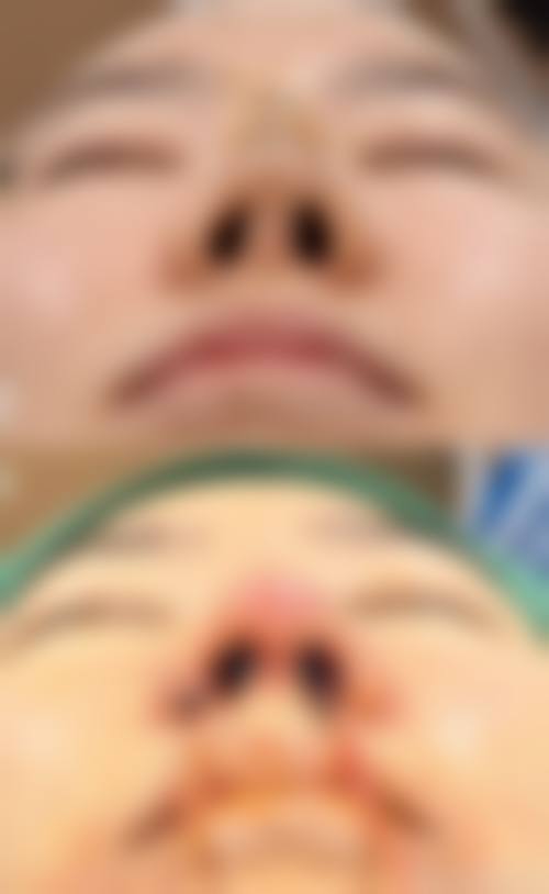 温岭伊美隆四良整形医院擅长项目。