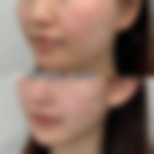 广州美黎美(郑毅医疗)预约挂号方式。