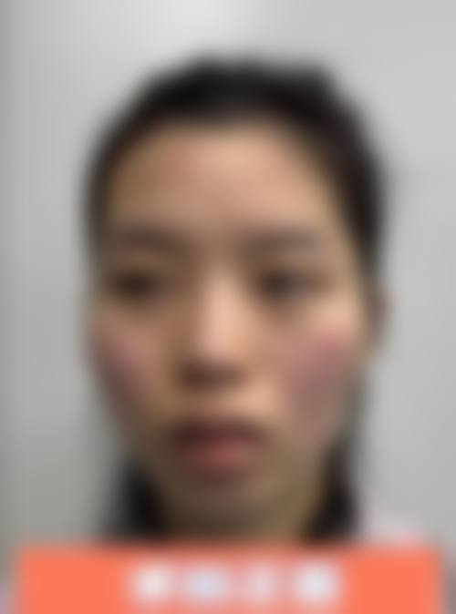 监利美嘉壹整形医院门诊营业时间。