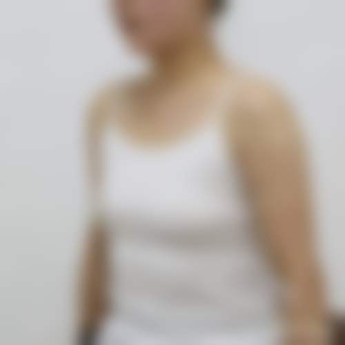 哈尔滨秀妍汇医疗美容门诊部顾客实例