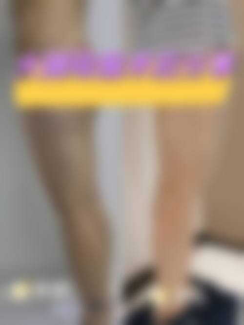 六、大腿吸脂的风险