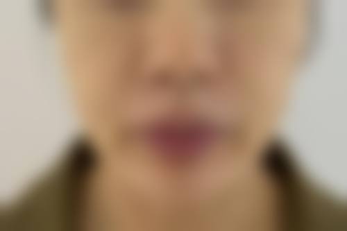 济南伊美尔加禾植发连锁机构擅长项目