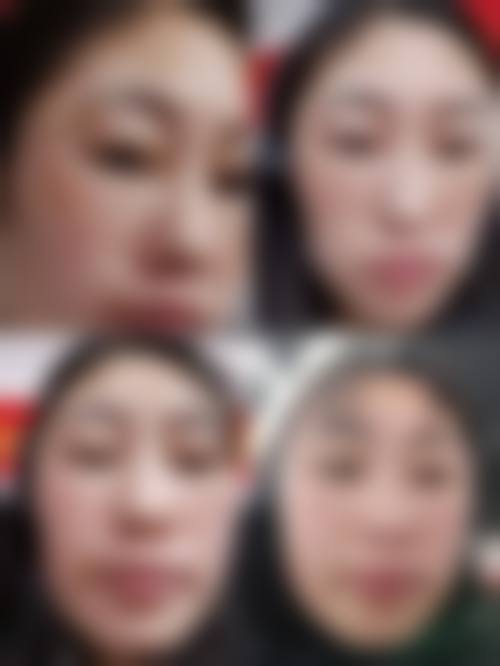 长沙伊臣整形医院擅长项目。