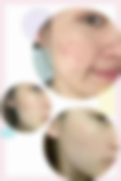 八、患者常见问题解答（精选 ）
