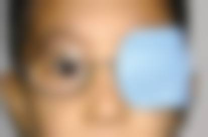 鄂尔多斯市达拉特旗人民医院眼科预约挂号方式。