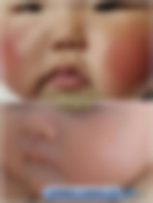 澧县人民医院眼科门诊营业时间。