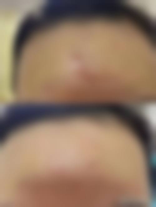 十、山东美诺医学美容医院真人口碑实例评价一览