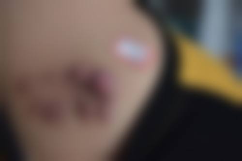 二、上海爱美仕医院整形美容中 心怎么样