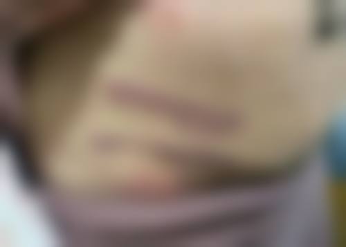 上海爱美仕医院整形美容中 心温馨提示——为了节省您的时间,看诊前请预约哦!