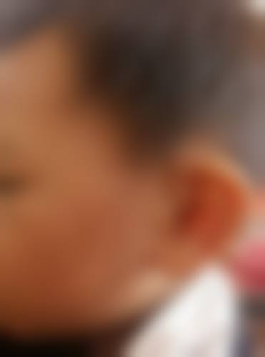 十一、深圳悦心悦时医疗美容诊所真人口碑实例评价一览