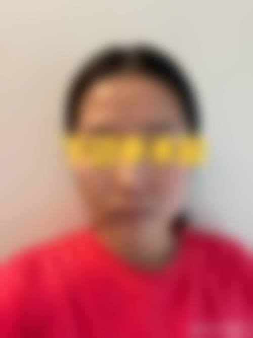 范荣杰医生技术实力展现