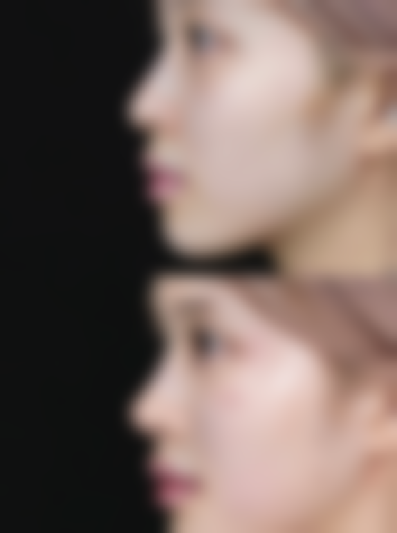 十、张圆圆医生相关科普内容推荐——眼部综合整形