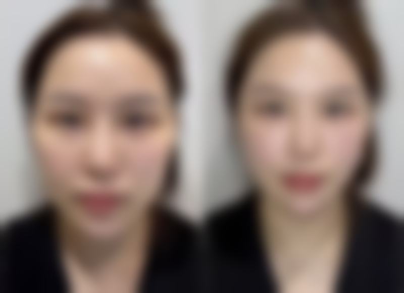 厦门长庚医院整形美容科擅长项目