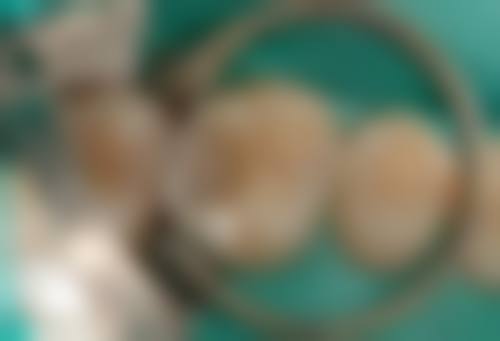 珠海蛀牙補牙幾錢2026最新收費標準！公立vs私家1顆牙實價大公開