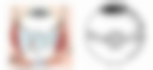 五、孩子眼后巩膜加固术适合人群