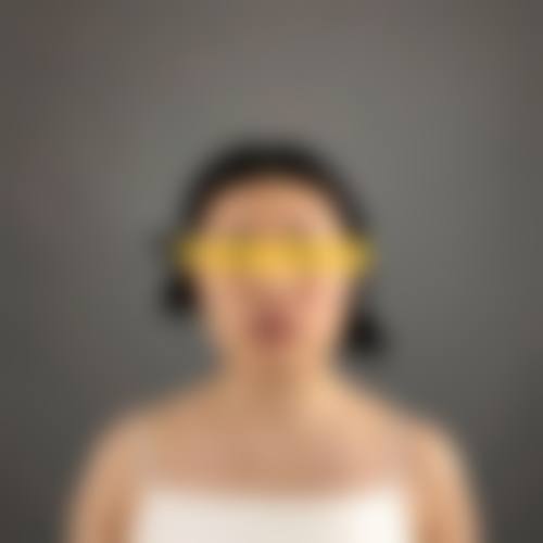 四、补下颌角缺失好大夫