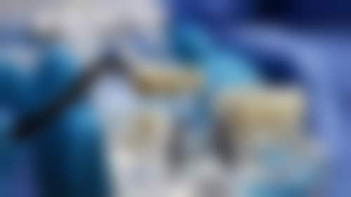 深圳罗湖区人民医院口腔科医生团队经验稳定。